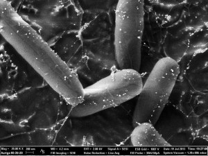 E. coli bacteria viewed with electron microscopy. Image by Zeiss Microscopy via Flickr. 